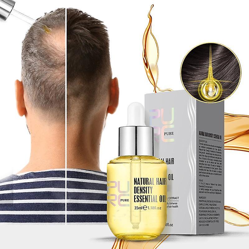 Ginger Essence Hair Growth Products Fast Regrowth Oil Care Scalp Treatment 35Ml