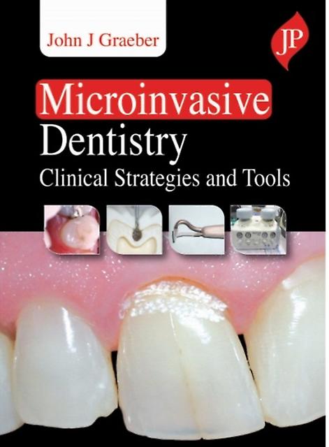 Microinvasive Dentistry - John J Graeber - Hardback - English Book - Dentistry