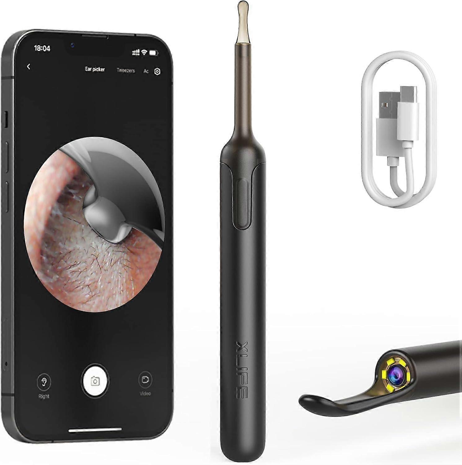 Ear Wax Removal with Camera