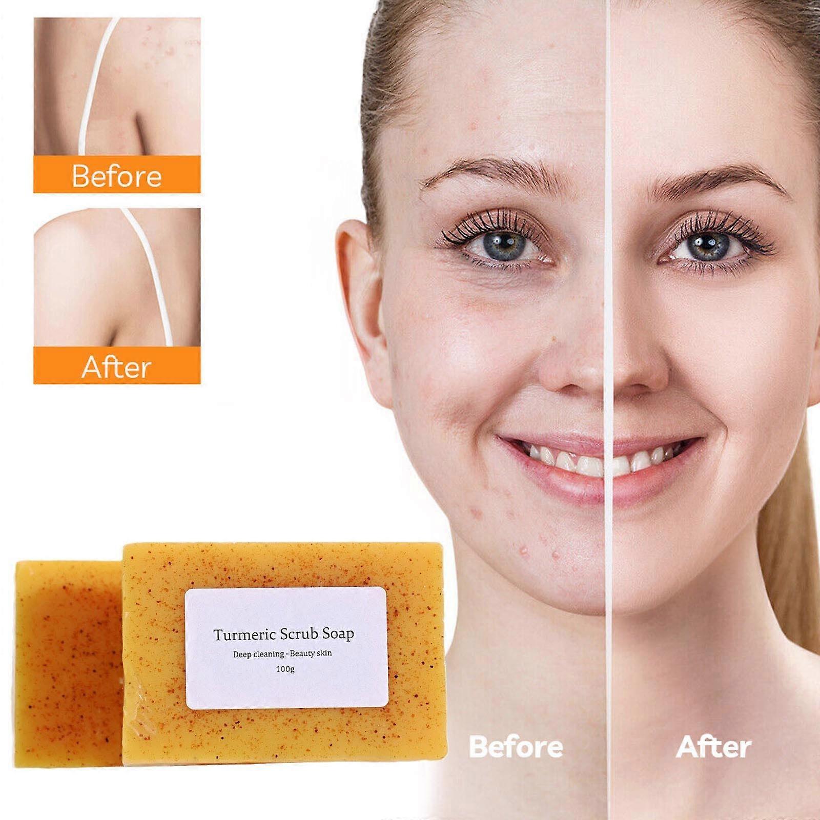 Hand Soap Lemon Turmeric Soap Tablets Cleansing Turmeric Soap Facial And Body Shower Soap Firming Pores And Removing Pigments