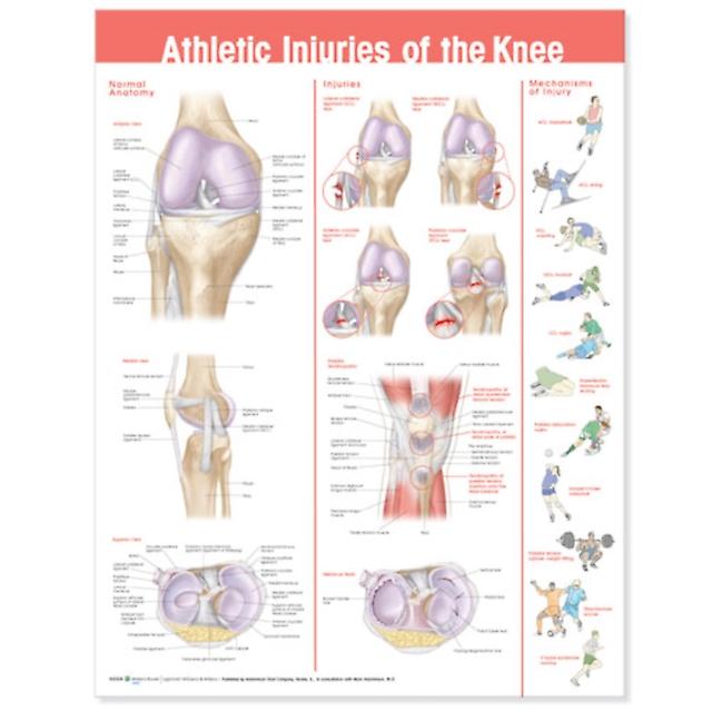Athletic Injuries Of The Knee Anatomical Chart by Wolters Kluwer Health Wallchart Book