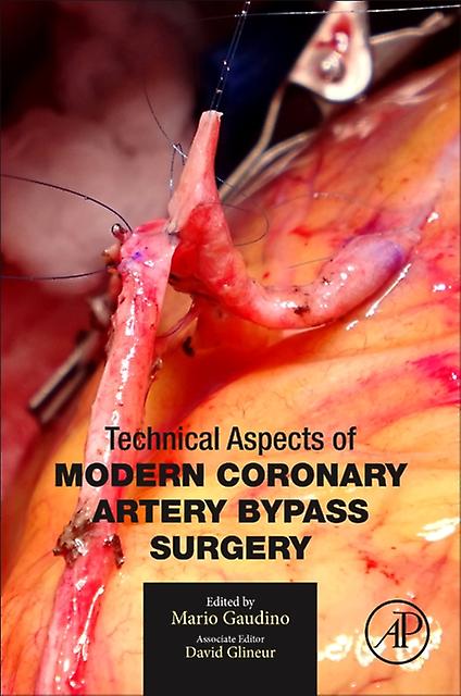 Technical Aspects Of Modern Coronary Artery Bypass Surgery Paperback Book