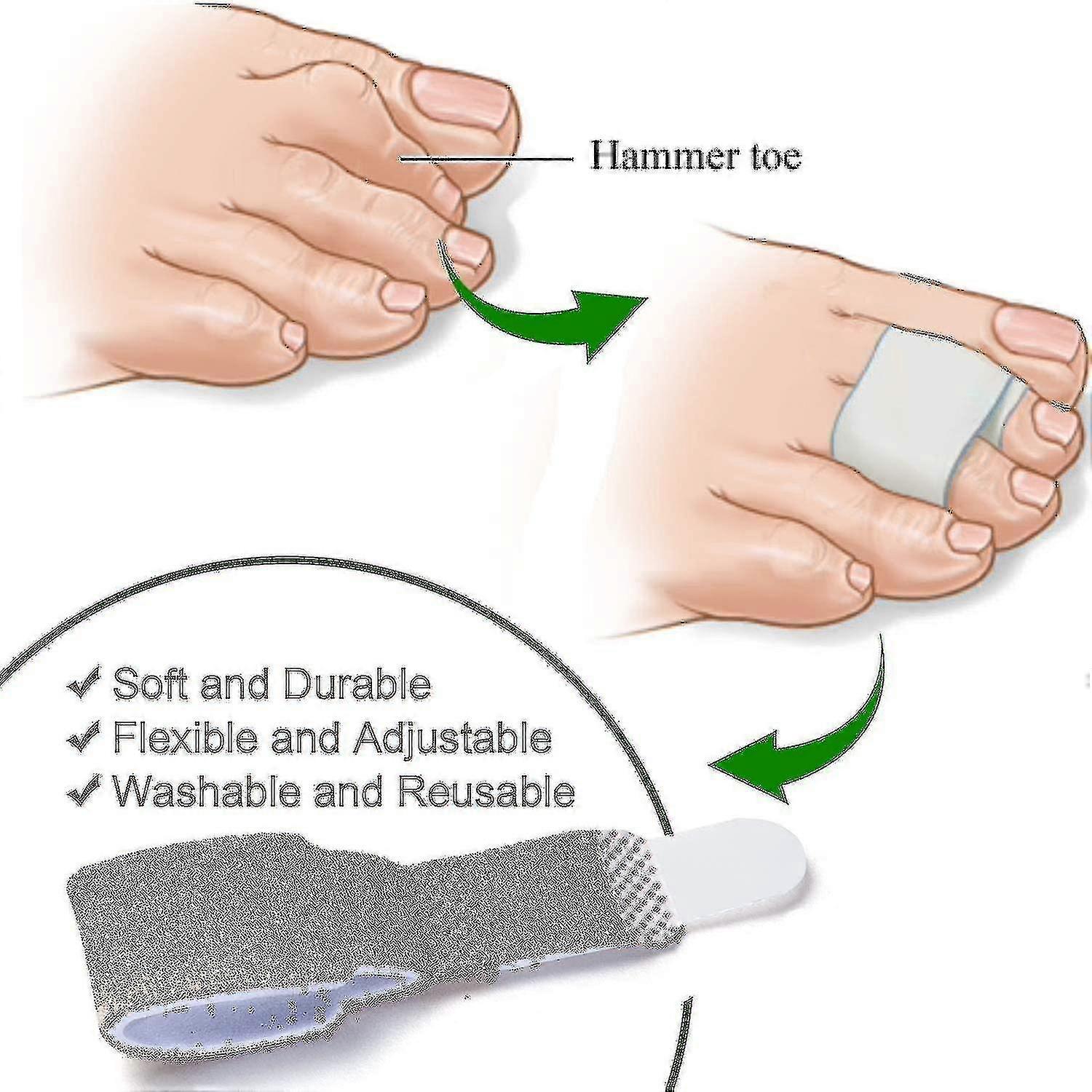 12 حزمة من أدوات فرد إصبع القدم المطرقة لاستقامة أصابع المطرقة
