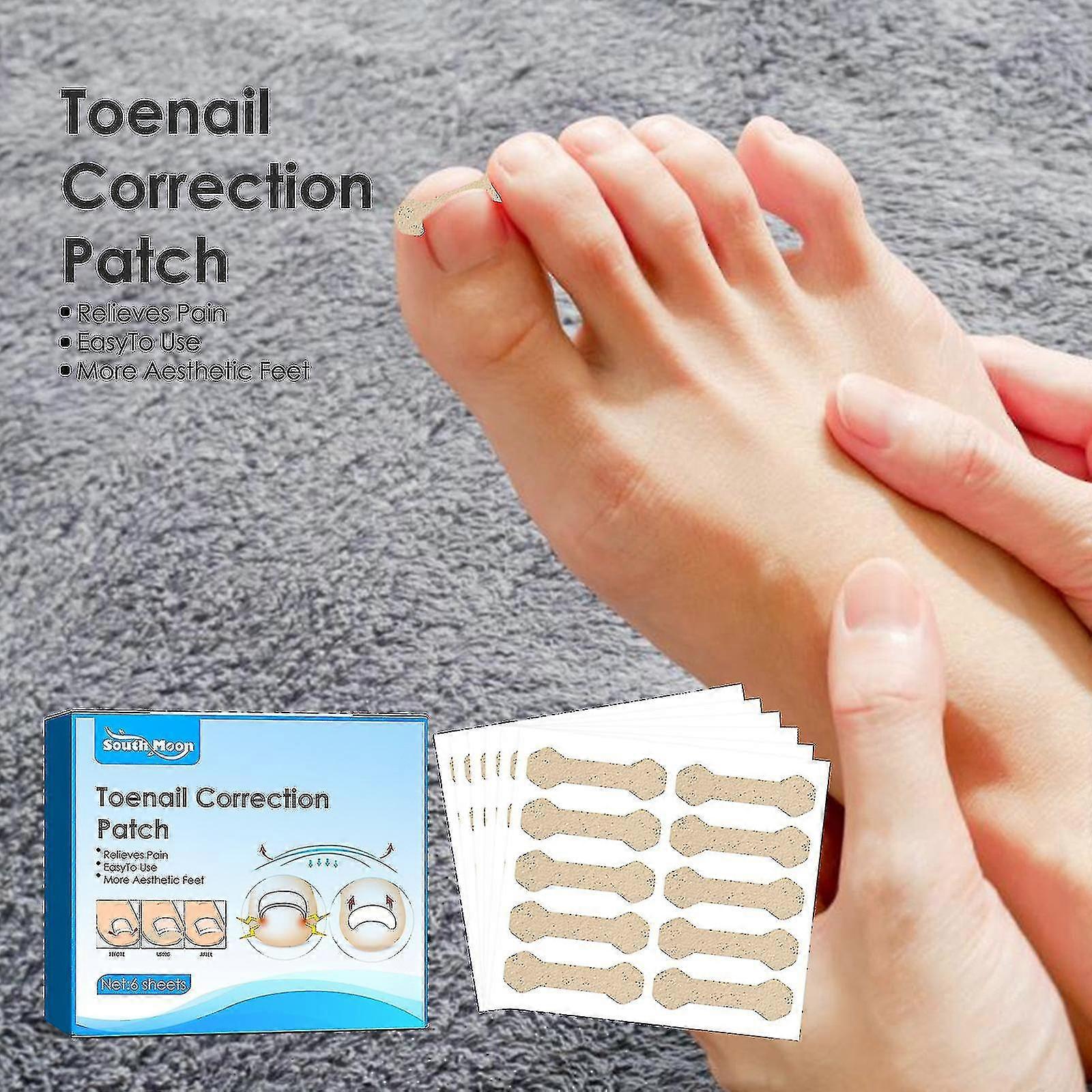 Nail Corrector Sticker - Ingrown Toenail Correction Patch for Manicure