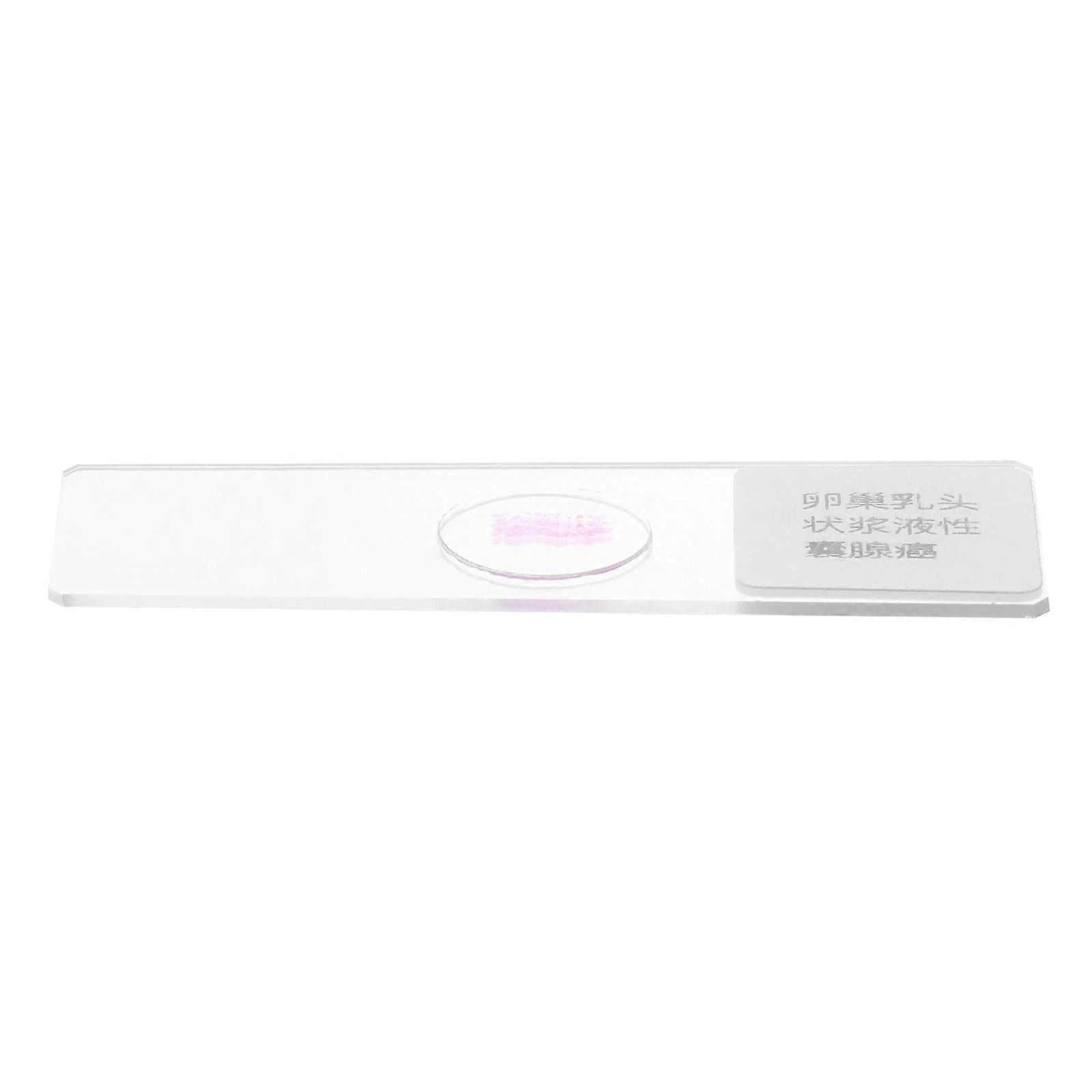 It seems like you're looking for information or a description related to **prepared microscope slides**, specifically for **Cystadenocarcinoma