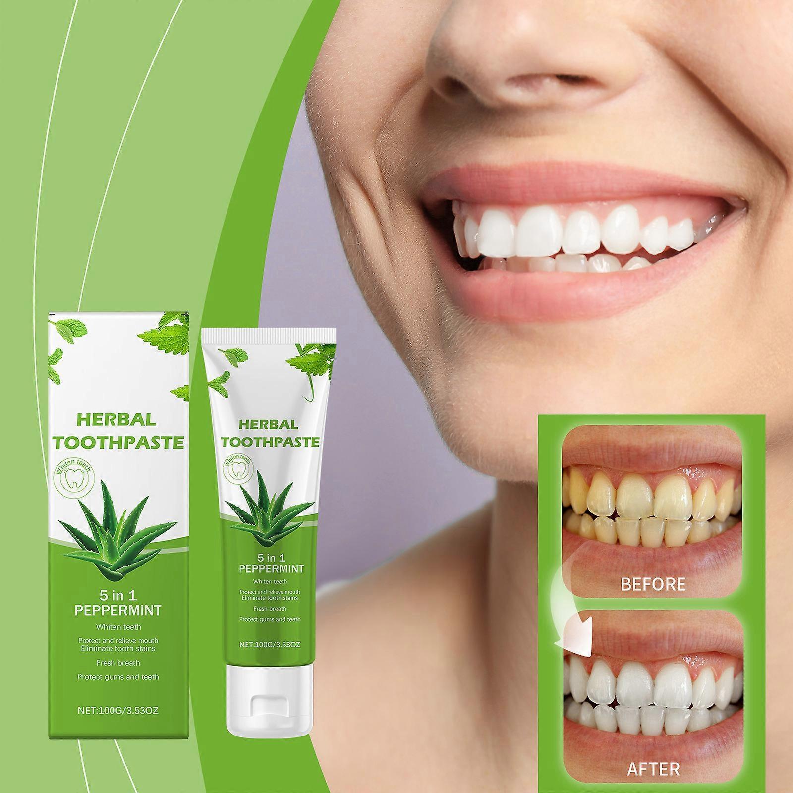 AloeVera Stain Removing Toothpaste Whitens Teeth And Removes Yellow Tooth Stains Toothpaste Protects Tooth Enamel And Promotes Teeth Health 100g Flye1