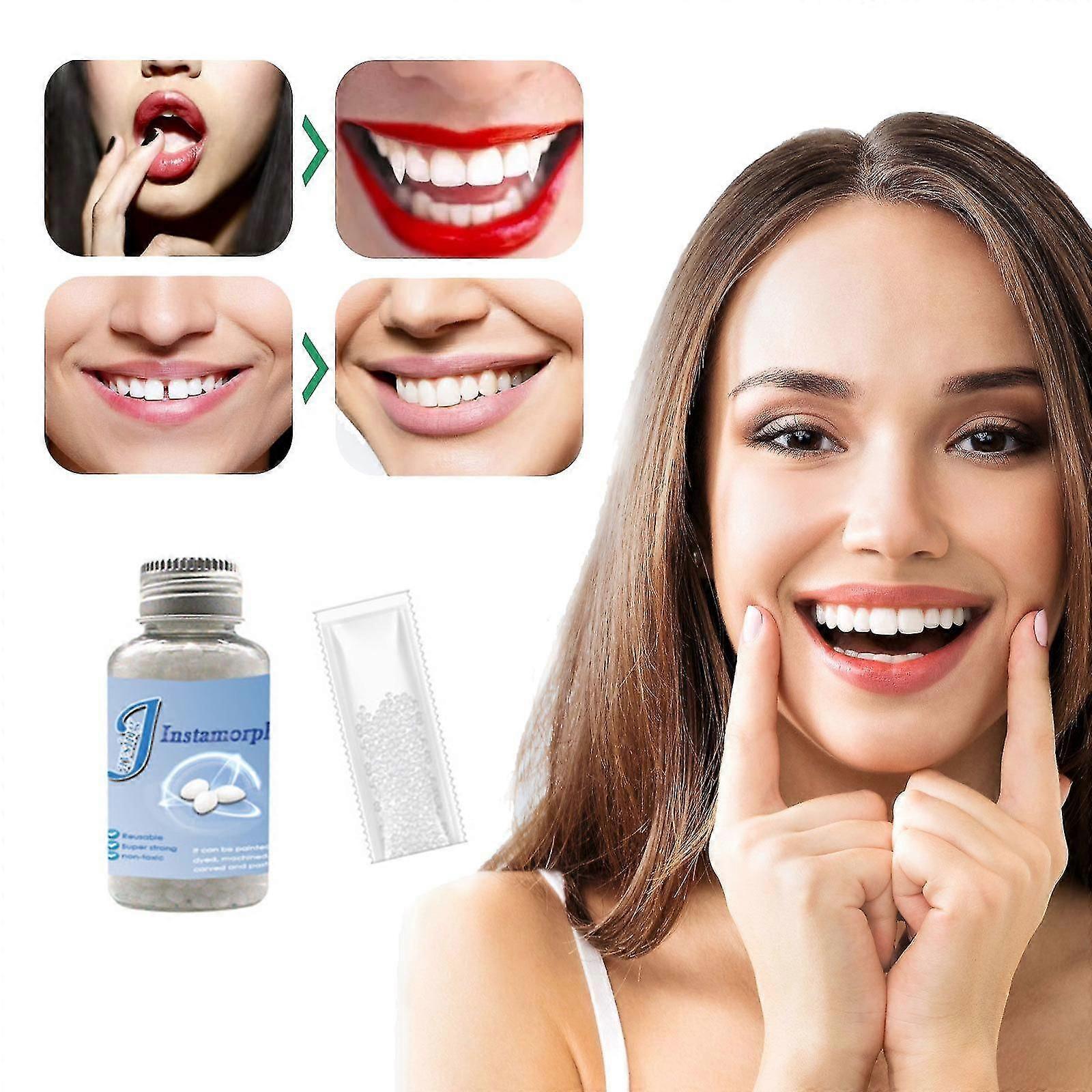 Temporary Tooth Filling, Solid Material Replacement - Denture Retainer