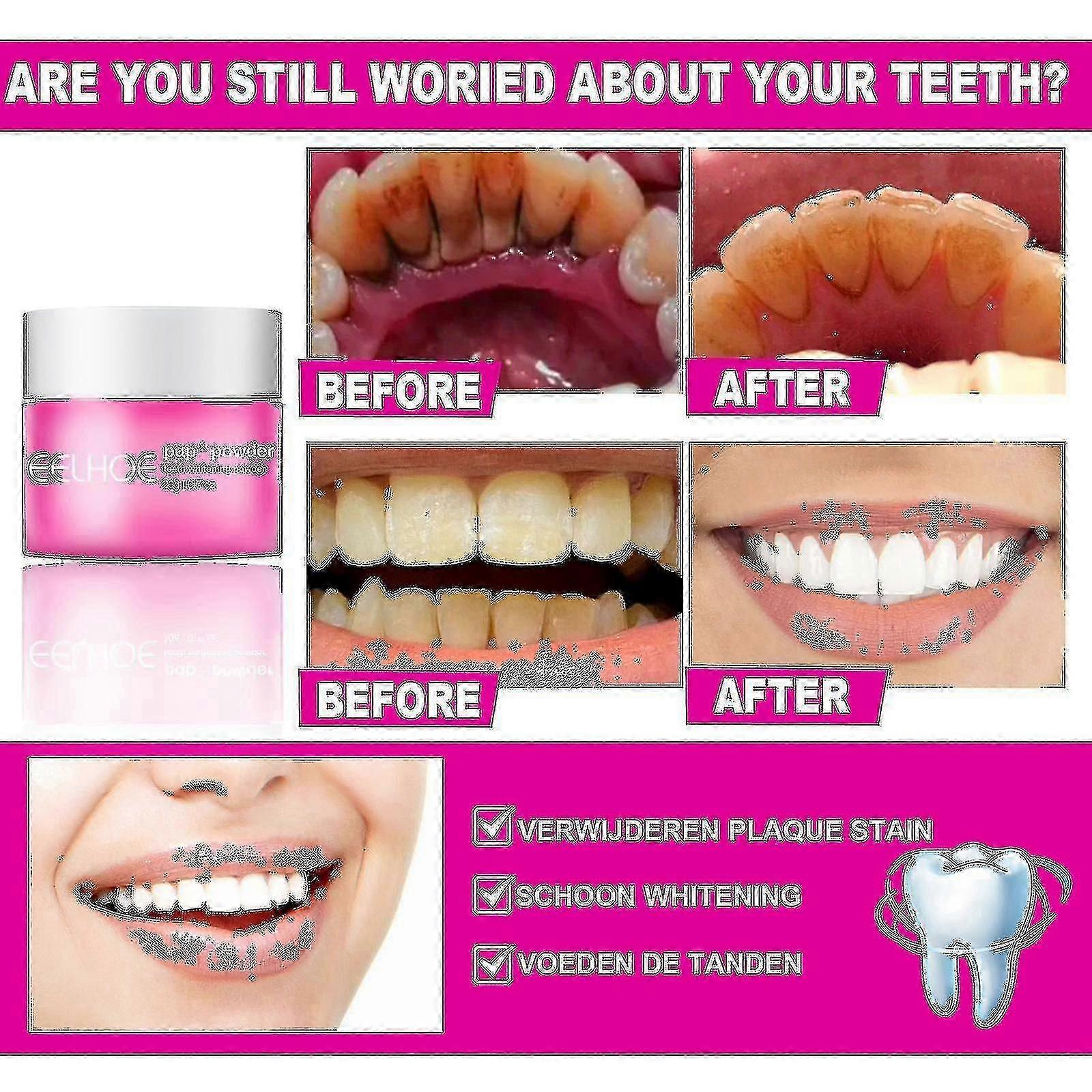 Tooth Removes Tartar, , Cleaning, Teeth , Bad , Teeth266