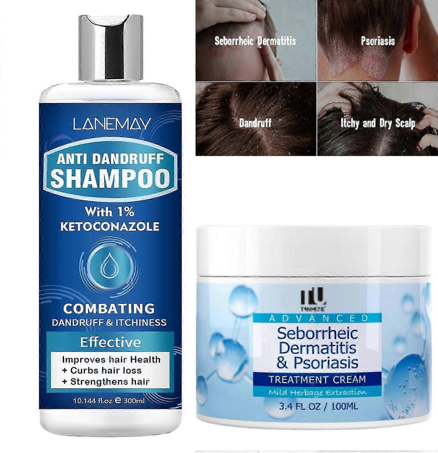 Anti Dandruff Shampoo & Seborrheic Dermatitis Cream Set, Scalp Treatment for Psoriasis, Folliculitis, Scalp Itchness Relief, Sooth, 300ML Anti Fungal