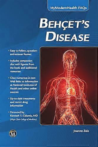 Behcets Disease