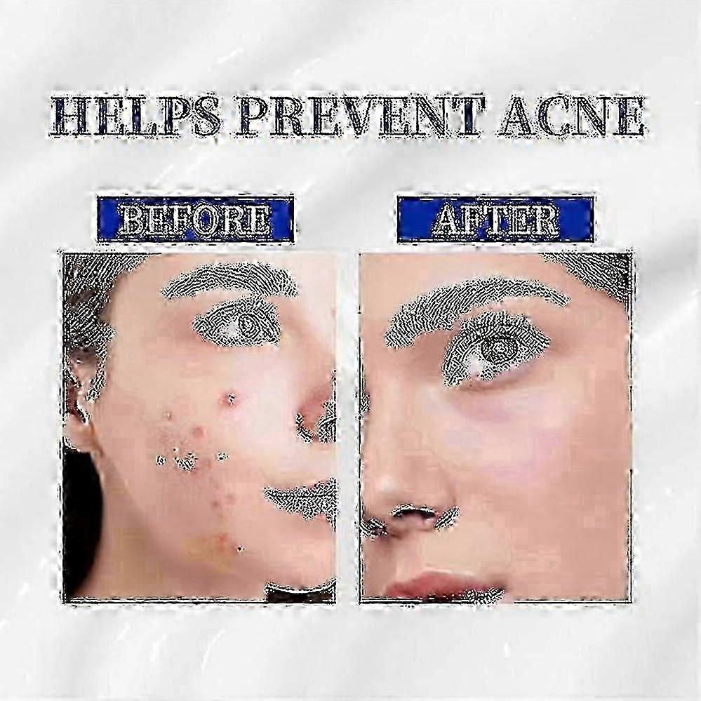 A-313 فيتامين أ كريم الريتينول A ~ 313 كريم الريتينول المضاد للشيخوخة للوجه ، يقلل من المسام والتجاعيد ، يعالج حب الشباب والبقع الداكنة