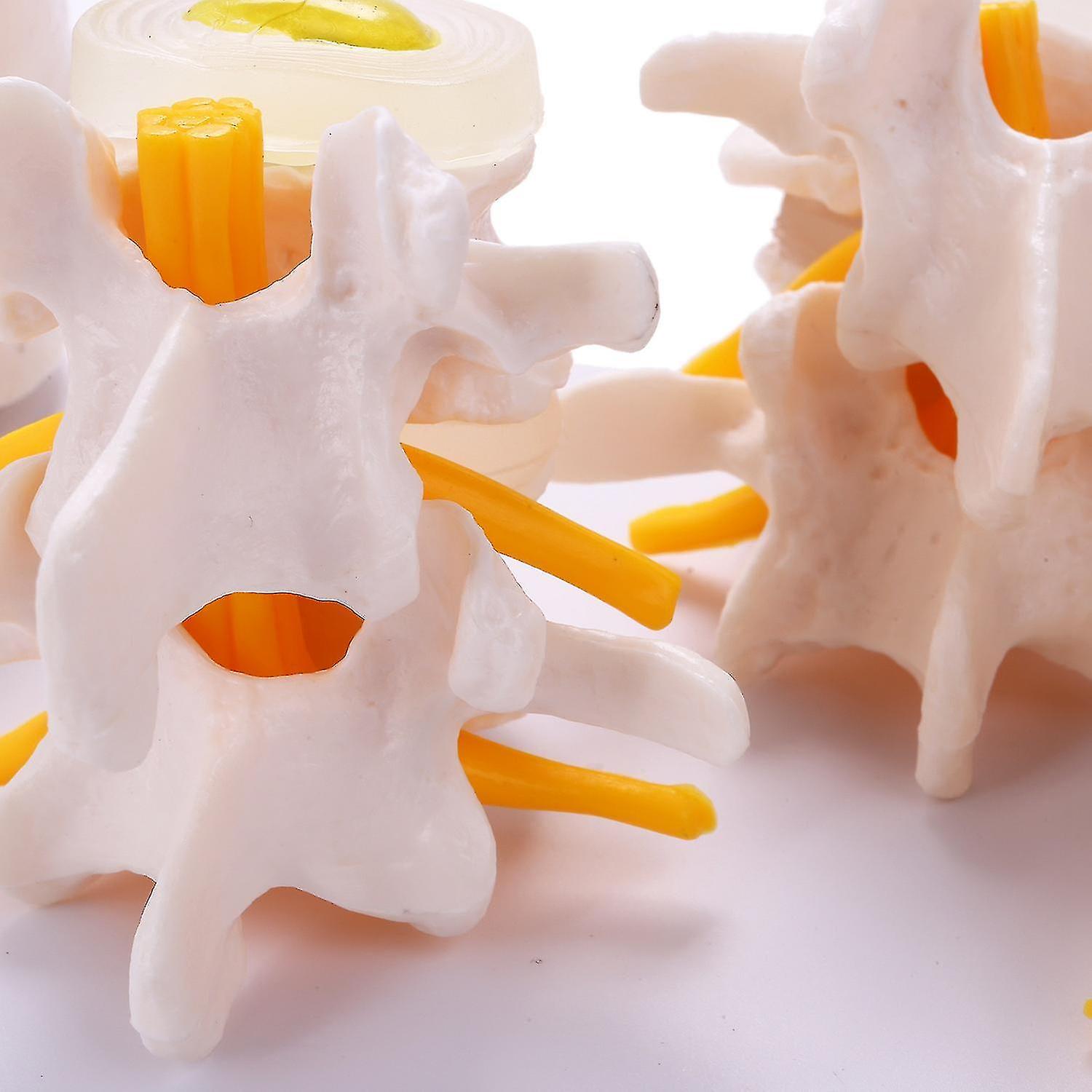 Human Anatomy Skeleton Spine 4-Stages Lumbar Vertebral Model Brain Skull Traumatic Medical Teaching Supplies