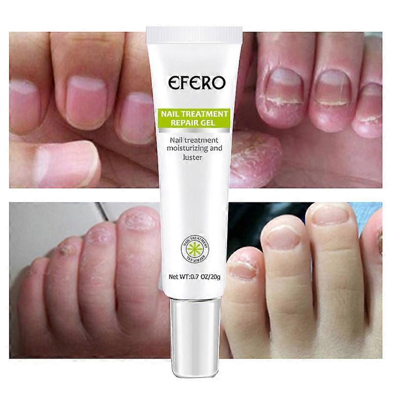 Fix-4- Nails 30ml main image 0