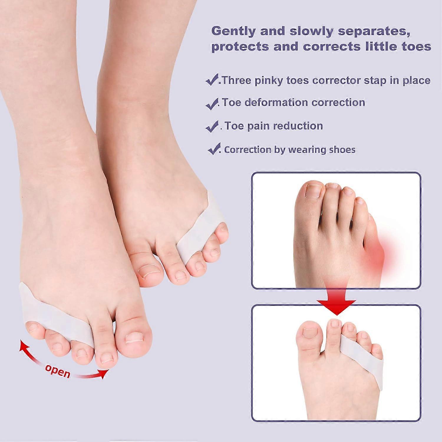 Toe Spacers for Bunions Little Toe Straightener 4 Pairs Silicone Toe Separators & Tailors Bunion Corrector