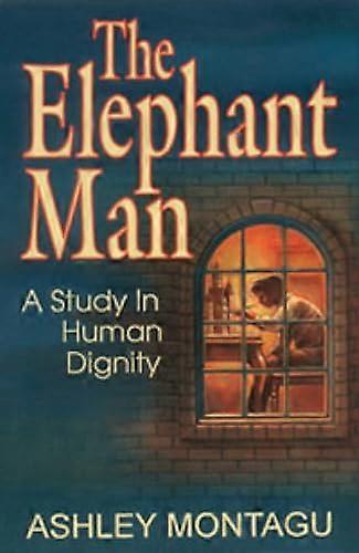 The Elephant Man