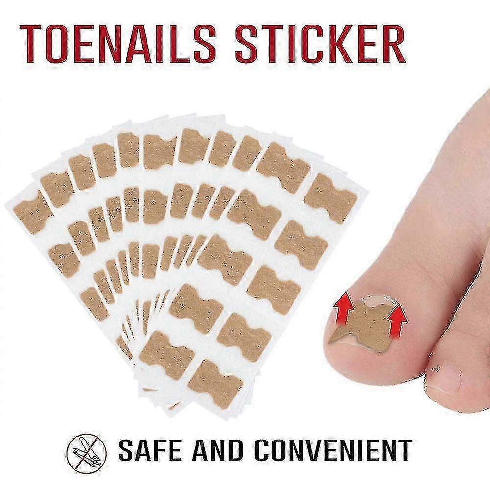 10/50pcs Toenail Correction Patch Glue Free Pedicure Tools Toe Nail Ingrown Patch Corrector