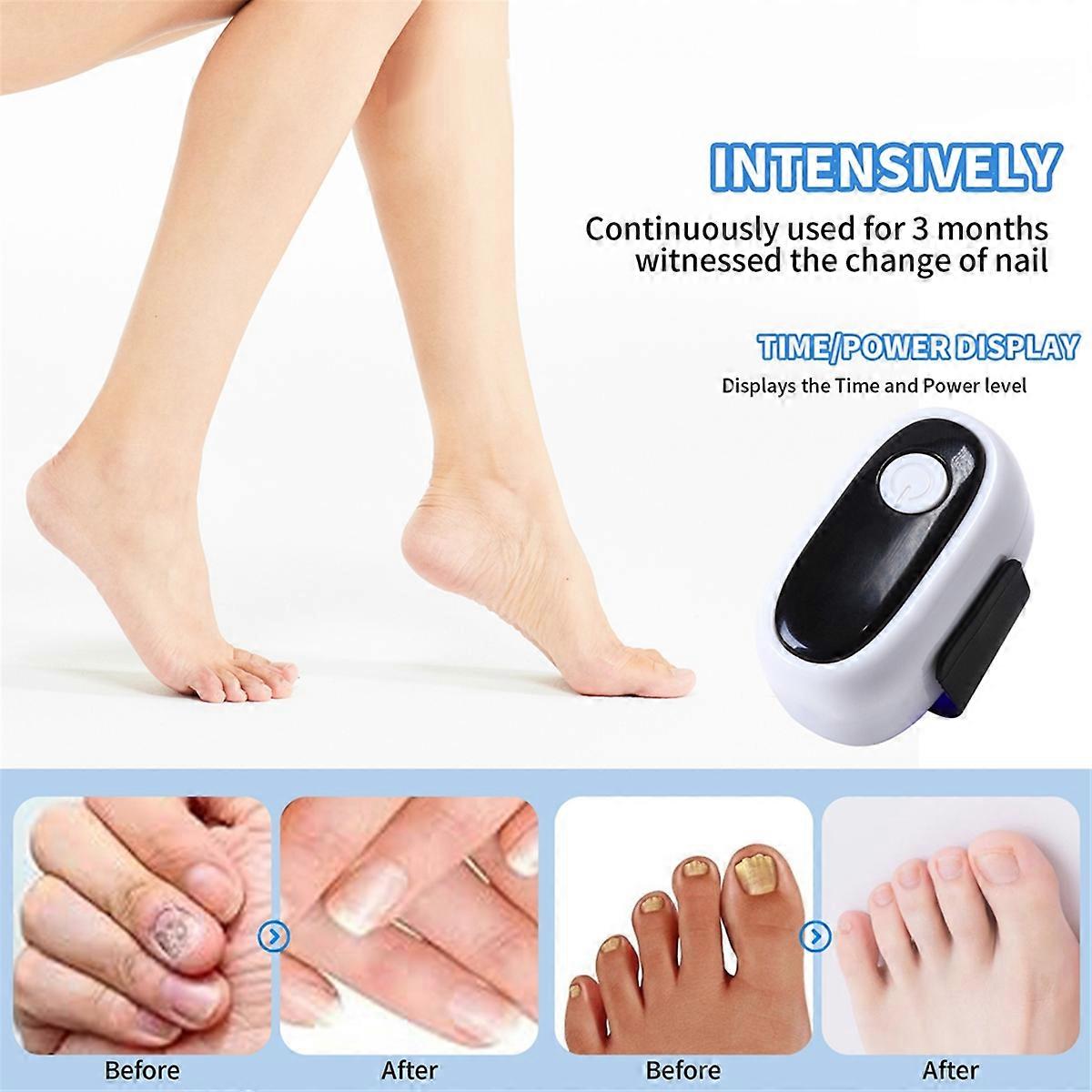 Neglelaserbehandlingsenhet for behandling av A