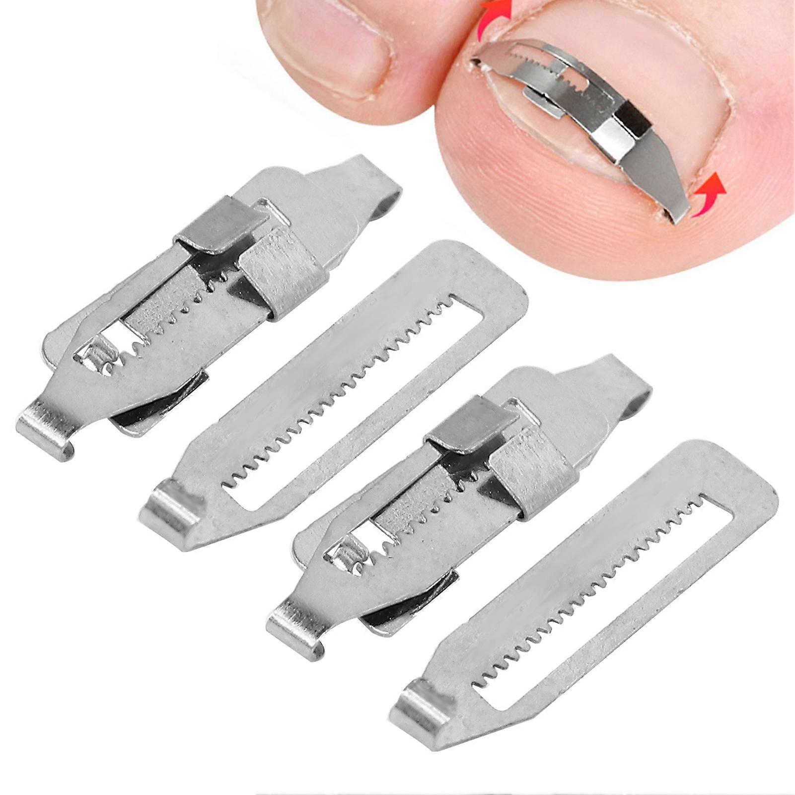 2PCS Ingrown Toenail Corrector Stainless Steel Paronychia Correction Tool for Toenail Correction