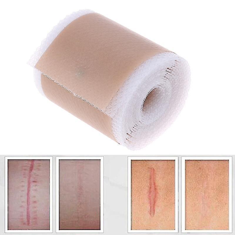 Efficient Surgery Scar Removal Silicone Gel Sheet Therapy Patch