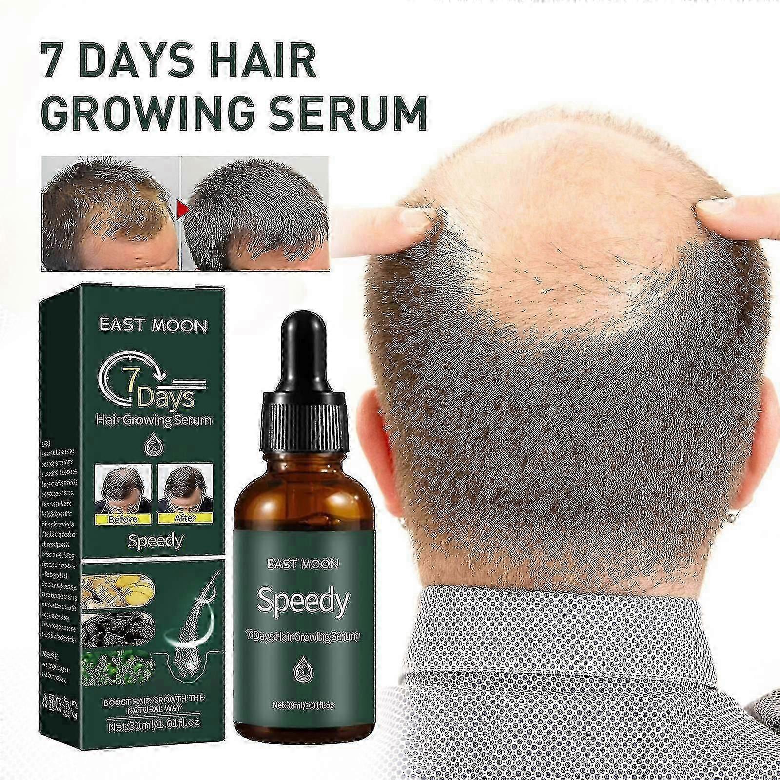 meilleure formule de sérum pour la croissance des cheveux 7 jours