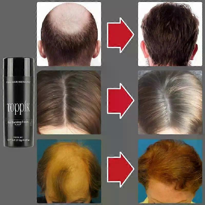 Toppik Hair Loss Building Fibers Hair Fibers Regrowth Powders Keratin ...