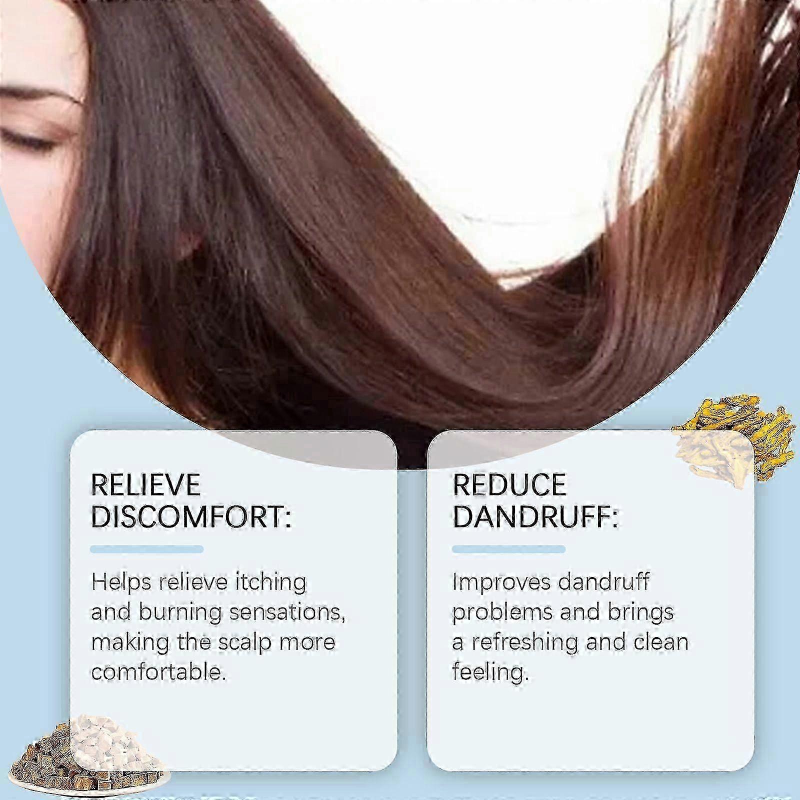 Seborrheic Dermatitis Cream, Psoriasis Cream, Scalp Relief for Psoriasis, Folliculitis, Dry Scalp, Dandruff, Seborrheic Dermatitis, Anti-Itch Cream, S