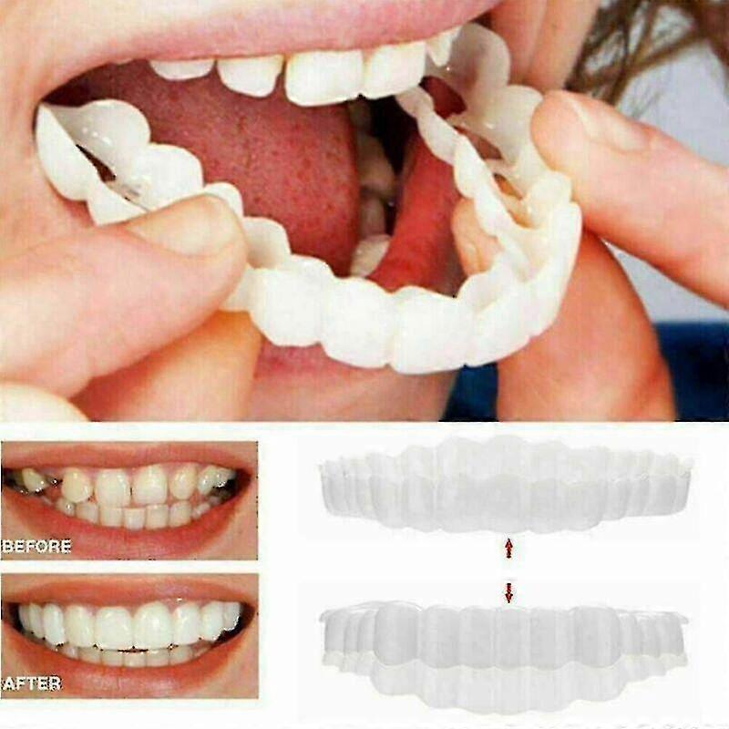 Snap Upper False Tooth Dental Veneers Dentures Fake Smile