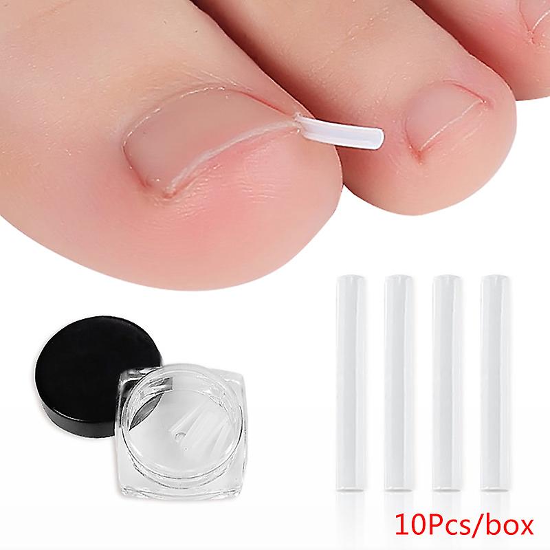 10pcs Toenail Straightening Clip Ingrown Toenail Correction Nail Patch Sticker