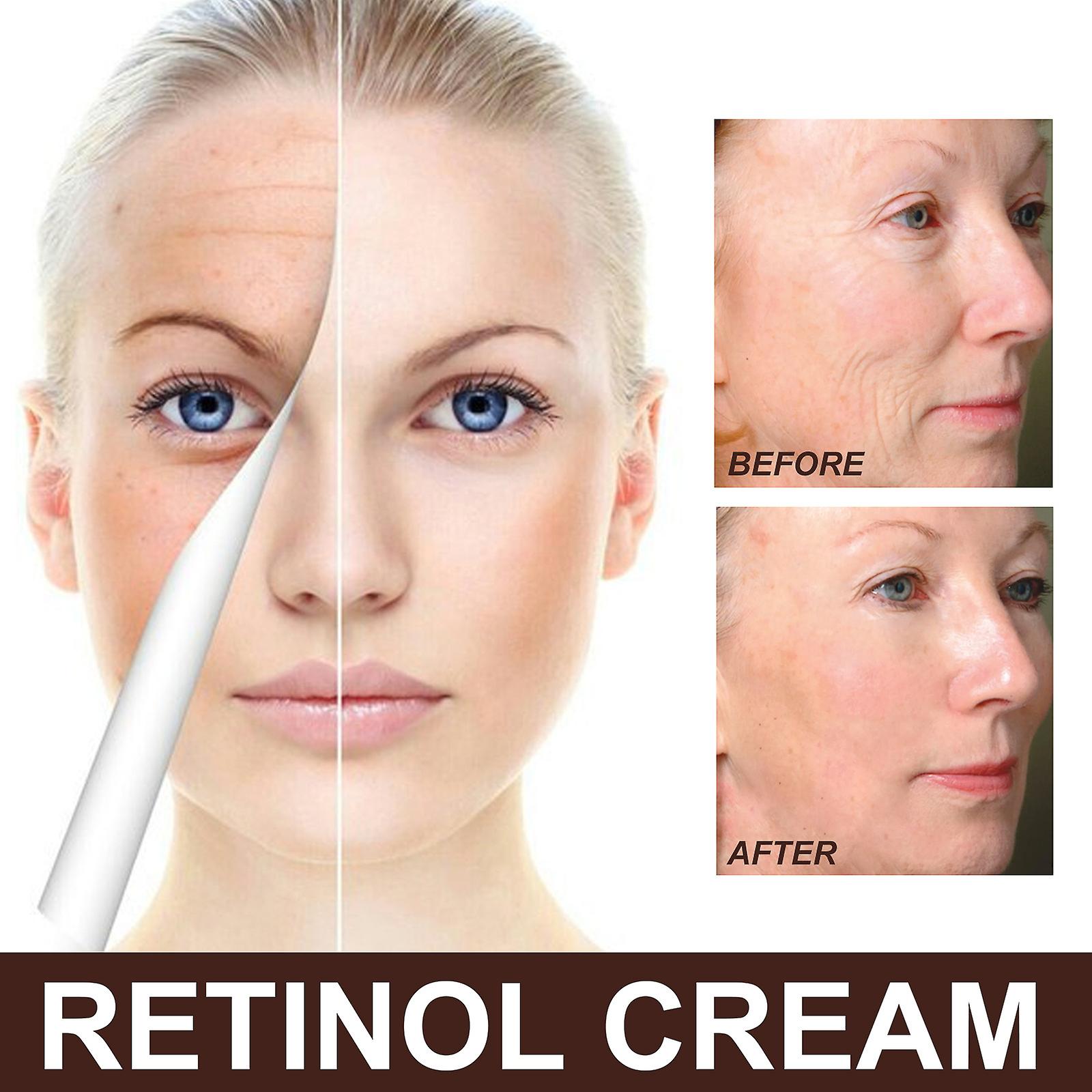 Retinol Cream Anti-Aging Face Moisturizer Wrinkle Cream Hydrating Water 30g