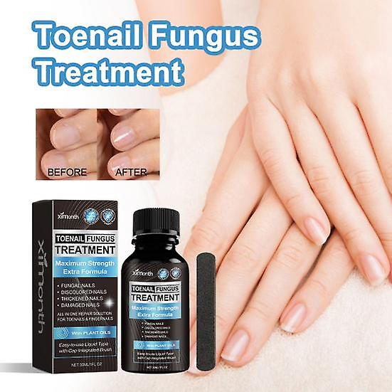 Extra Strength Nail Fungus Treatment Natural Repair Renew Solution with 7 Oils Easy Application Healthy Nails Solution for Toenail Fingernails