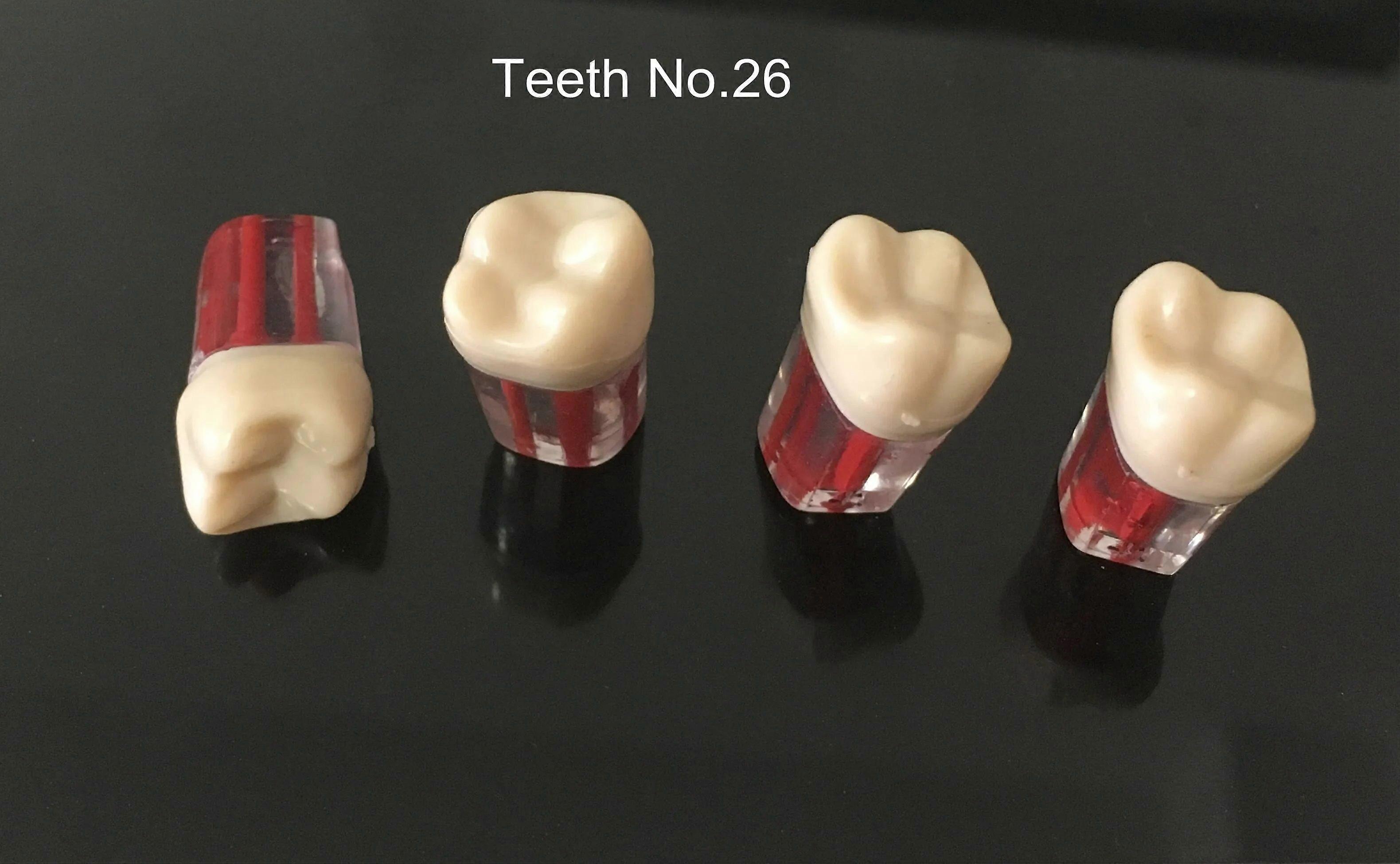 5pcs Dental Root Canal Teeth Study Practice Model for Endodontic Pulp File 11/16/26/36