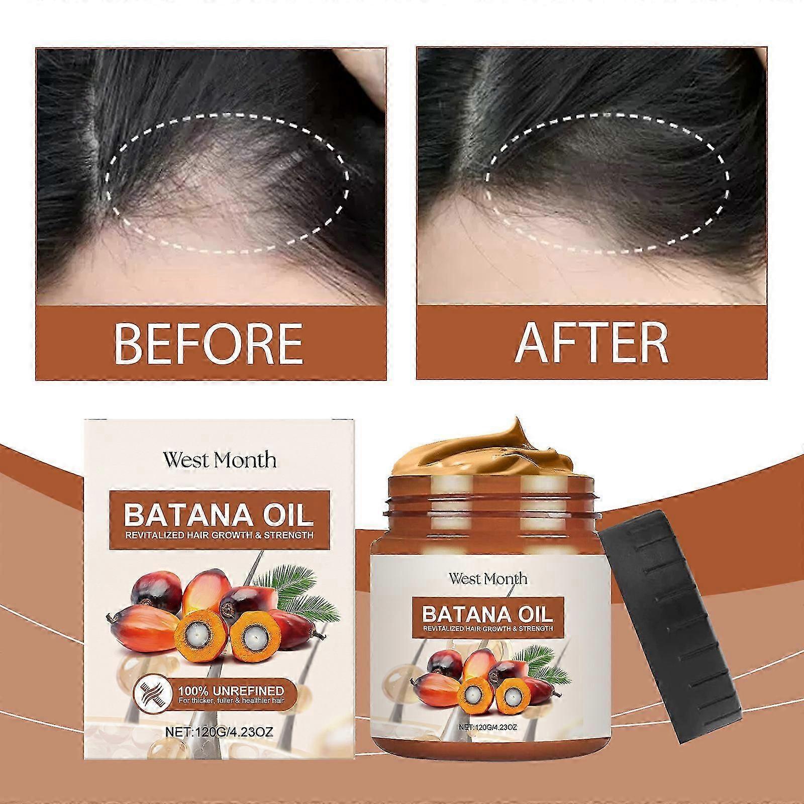 ヘアケア、育毛、ホンジュラス産バタナオイルのための100%天然バタナオイル、抜け毛を防ぎ、頭皮に潤いを与え、乾燥した髪を回復させます