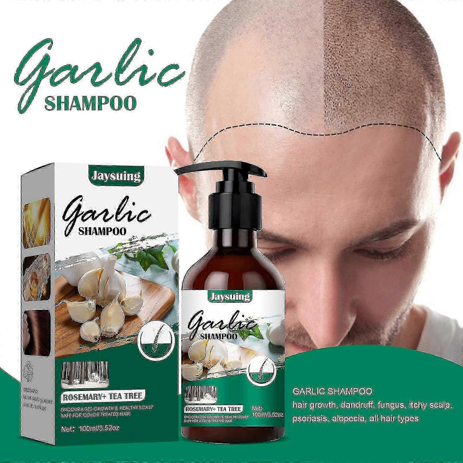 Jaysuing usturoi șampon, anti-mâncărime păr, șampon anti-matreata, anti-caderea parului și hrănire păr șampon & balsam 1buc |