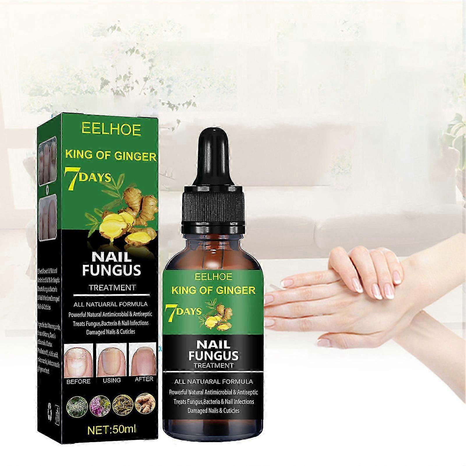 7 dagars nagelbehandling, ingefärsnagelbehandling, multifunktionell nagelreparation, nagelnäringsolja, stärkande oljeserum, ingefärsnageltillväxtolja
