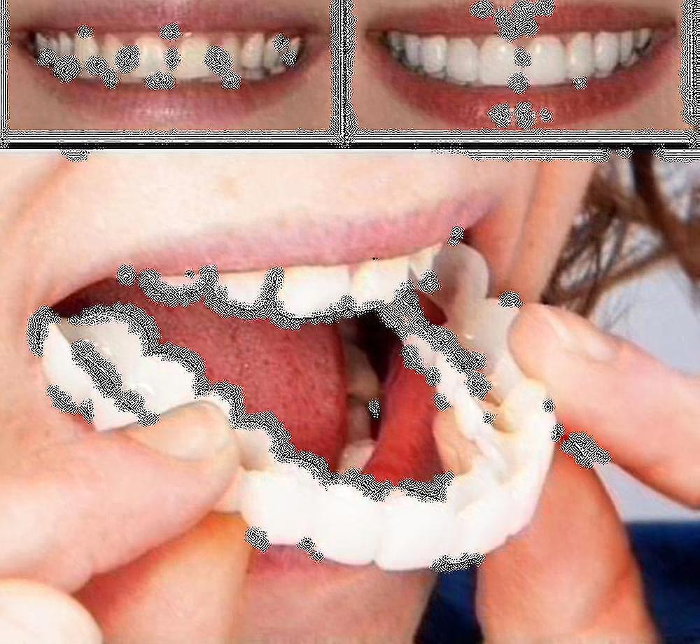 A ペア アッパー&ローワー 高品質 義歯 インスタントスマイル コンフォートフィット フレックス コスメティック 歯 義歯 トップ コスメティック ベニヤ ハイ