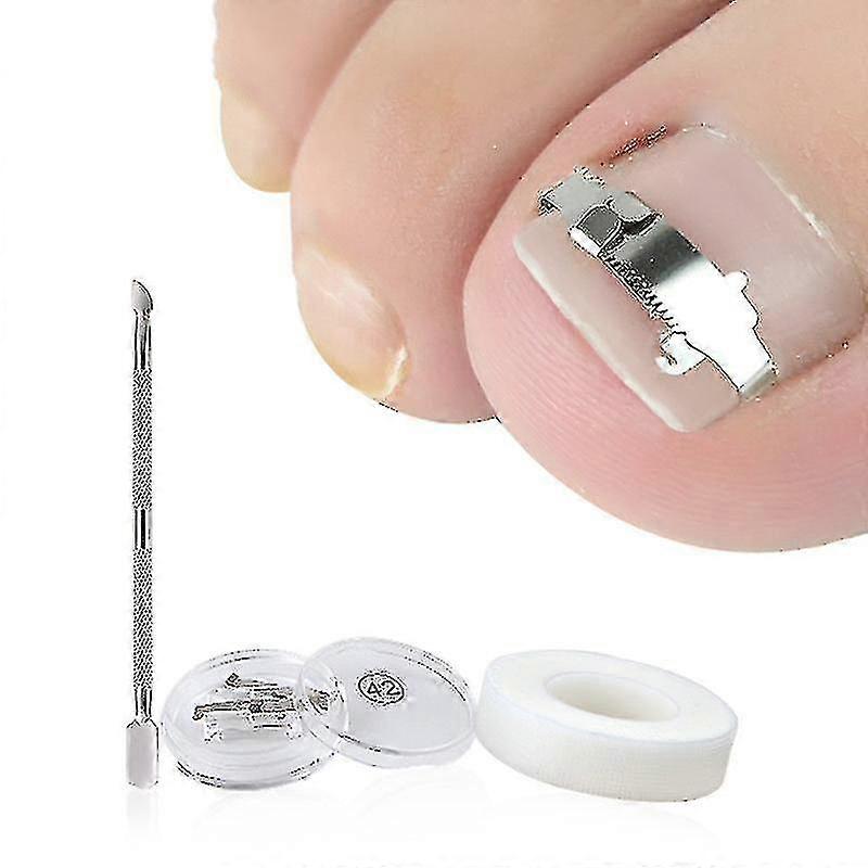 Ingrown Toenail Tool, Ingrown Toenail