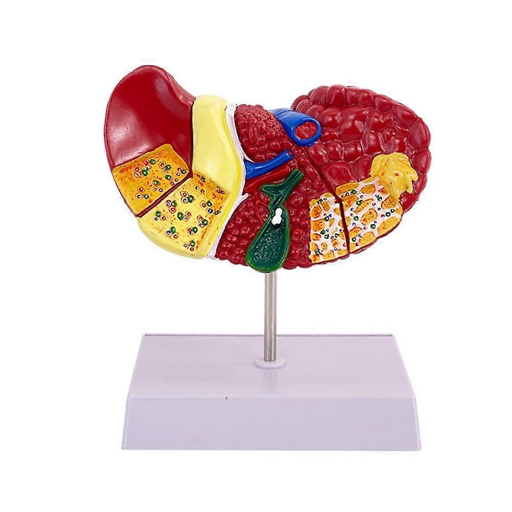 Liver Anatomy Model with Common Pathologies and Stable Base for Medical Education