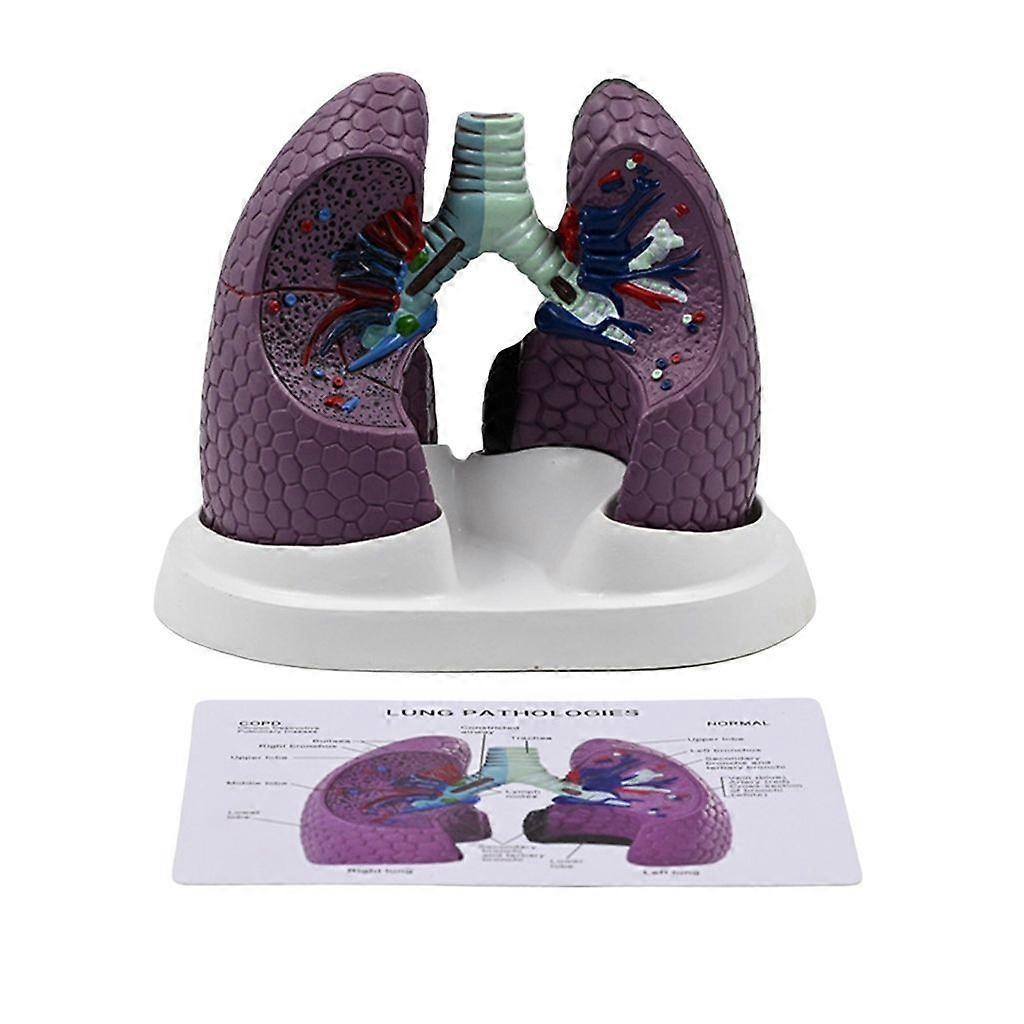 Anatomical Pathological Lung Model Normal and Pathological Lung Anatomy Model