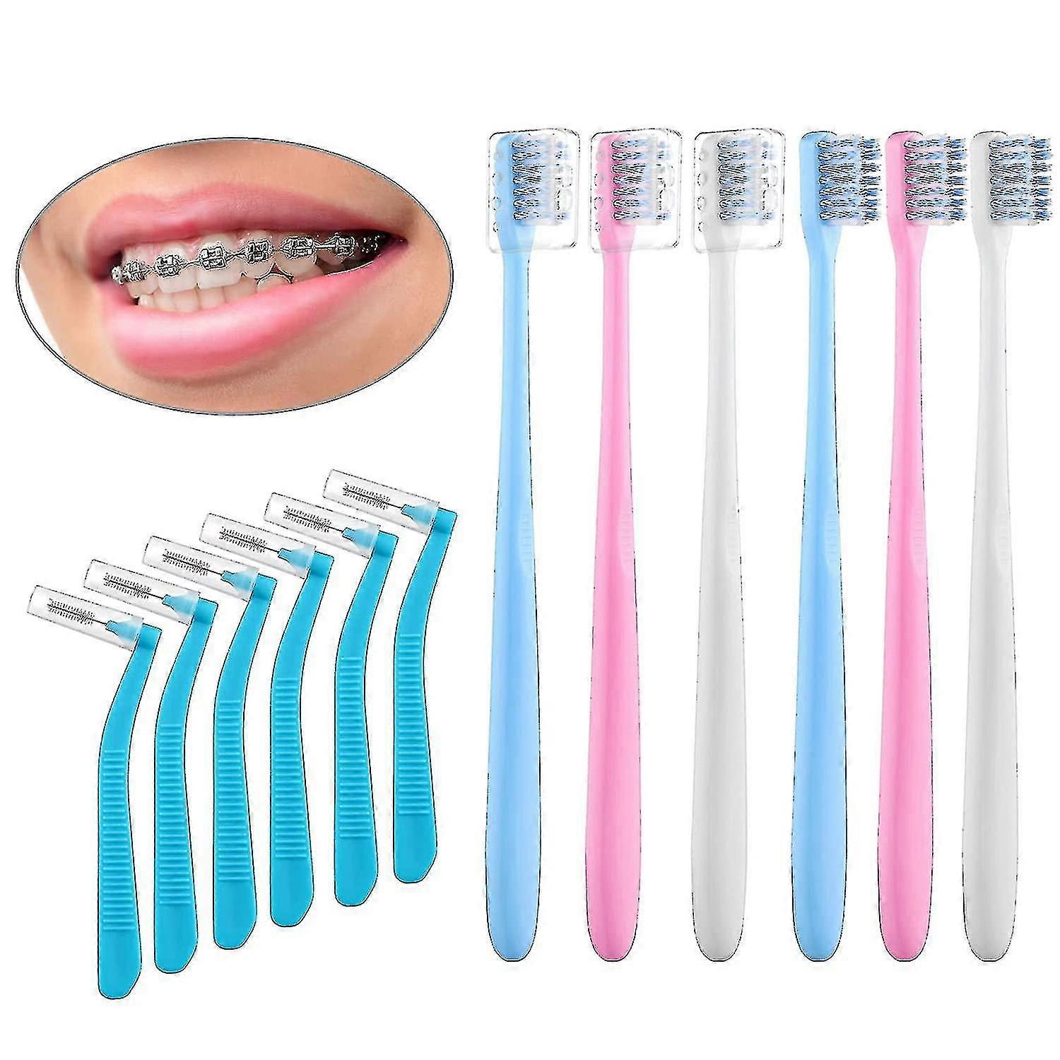 V-shaped Orthodontic Toothbursh For Braces, Soft Bristles, 6 Count