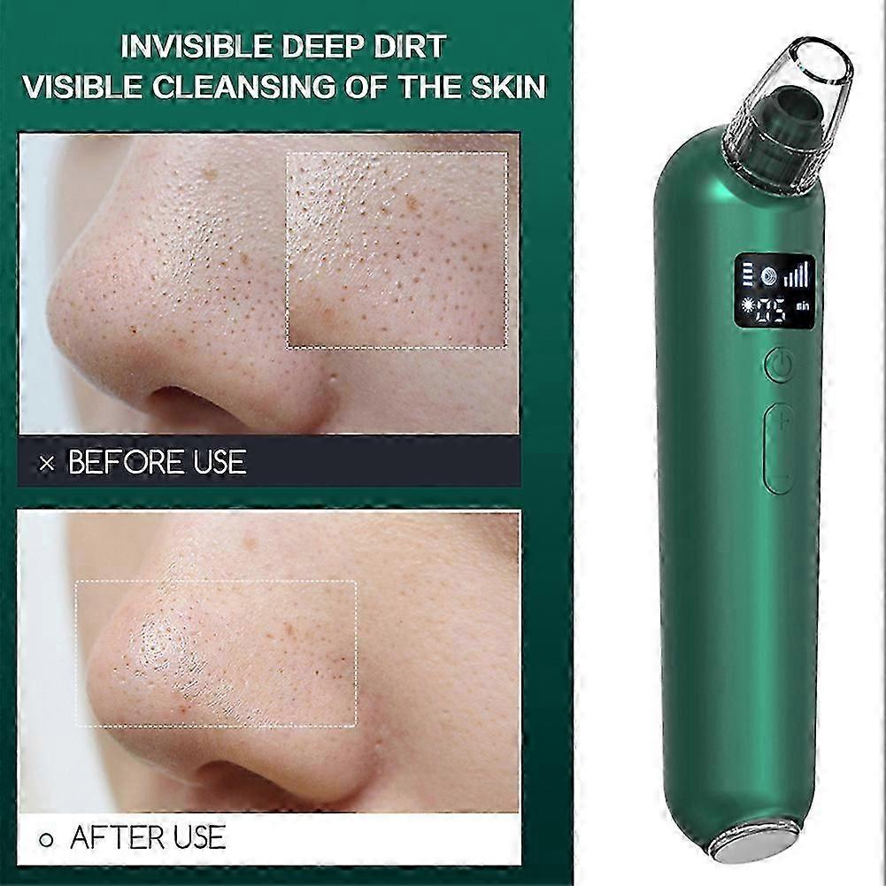 Electric Blackhead Remover Machine Cordless Low Noise Pore Cleaner Face Cleaning Tool