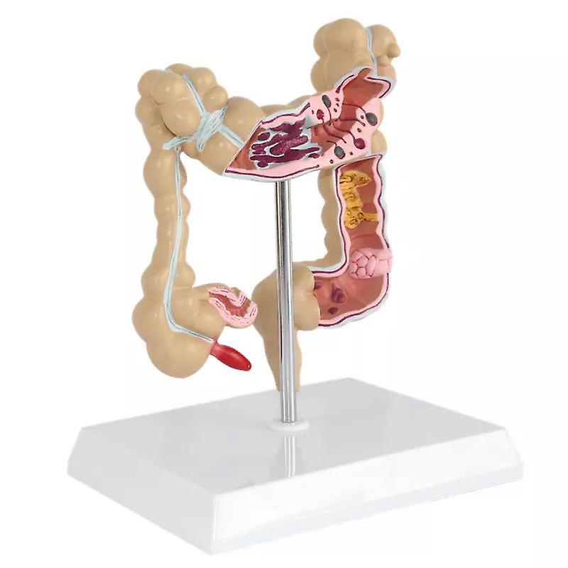 Human Model Simulation Human Colon Anatomy Model Anorectal Intestinal Gastrointestinal Digestive System Teaching Model
