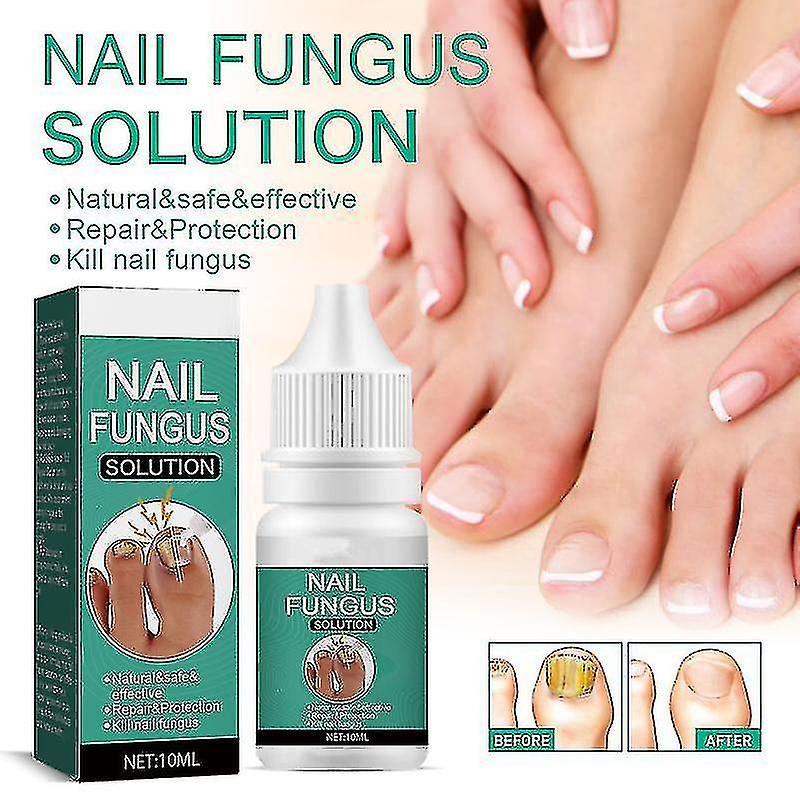 Svampnagelbehandling för tånagel Extra stark, Inåtväxande tånagelbehandling Nagelvårdsoljor, Tånagelsvamp Behandling AS