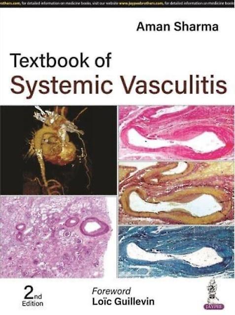 Textbook Of Systemic Vasculitis by Aman Sharma Paperback Book