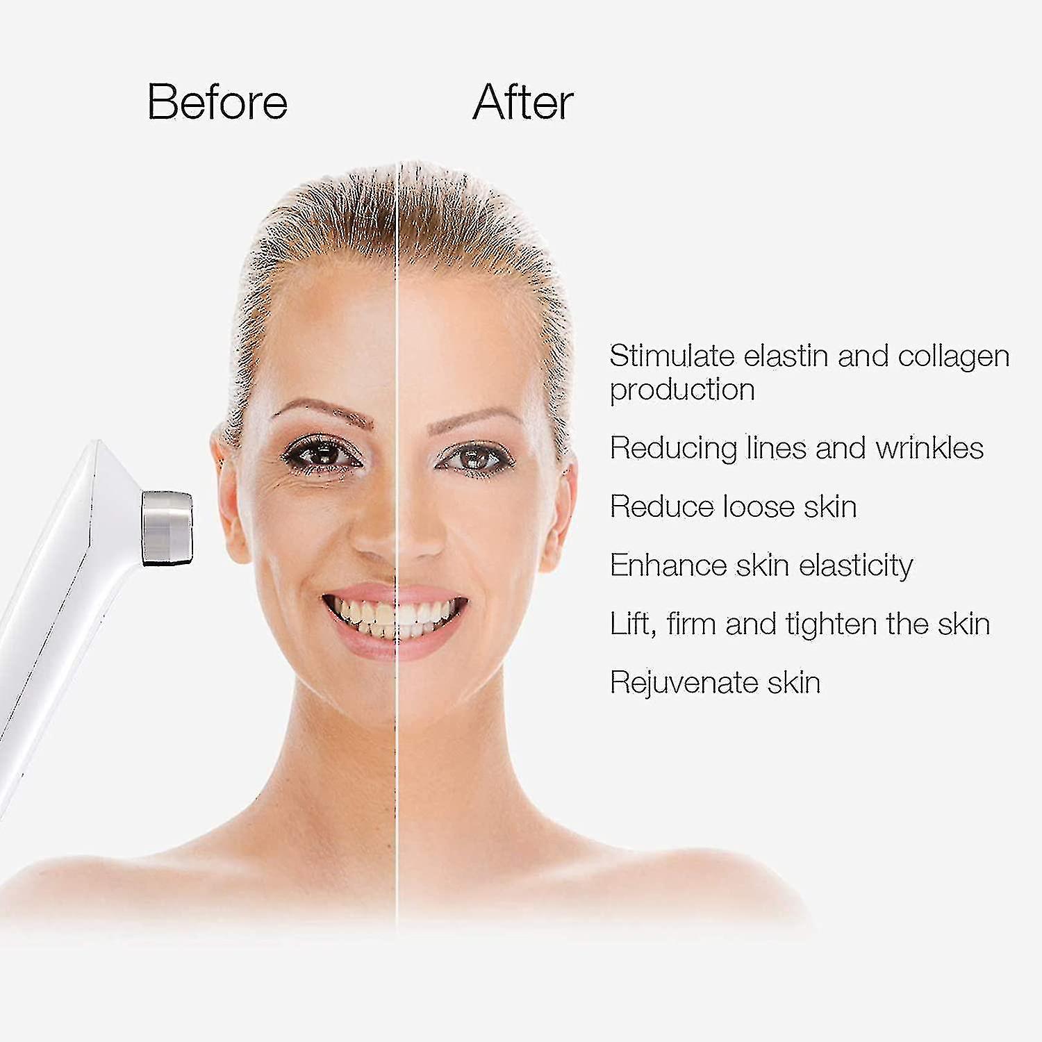 Μηχανή σχηματισμού για δέρμα προσώπου και σώματος με συσκευή ραδιοσυχνοτήτων-επαγγελματική αντιγήρανση