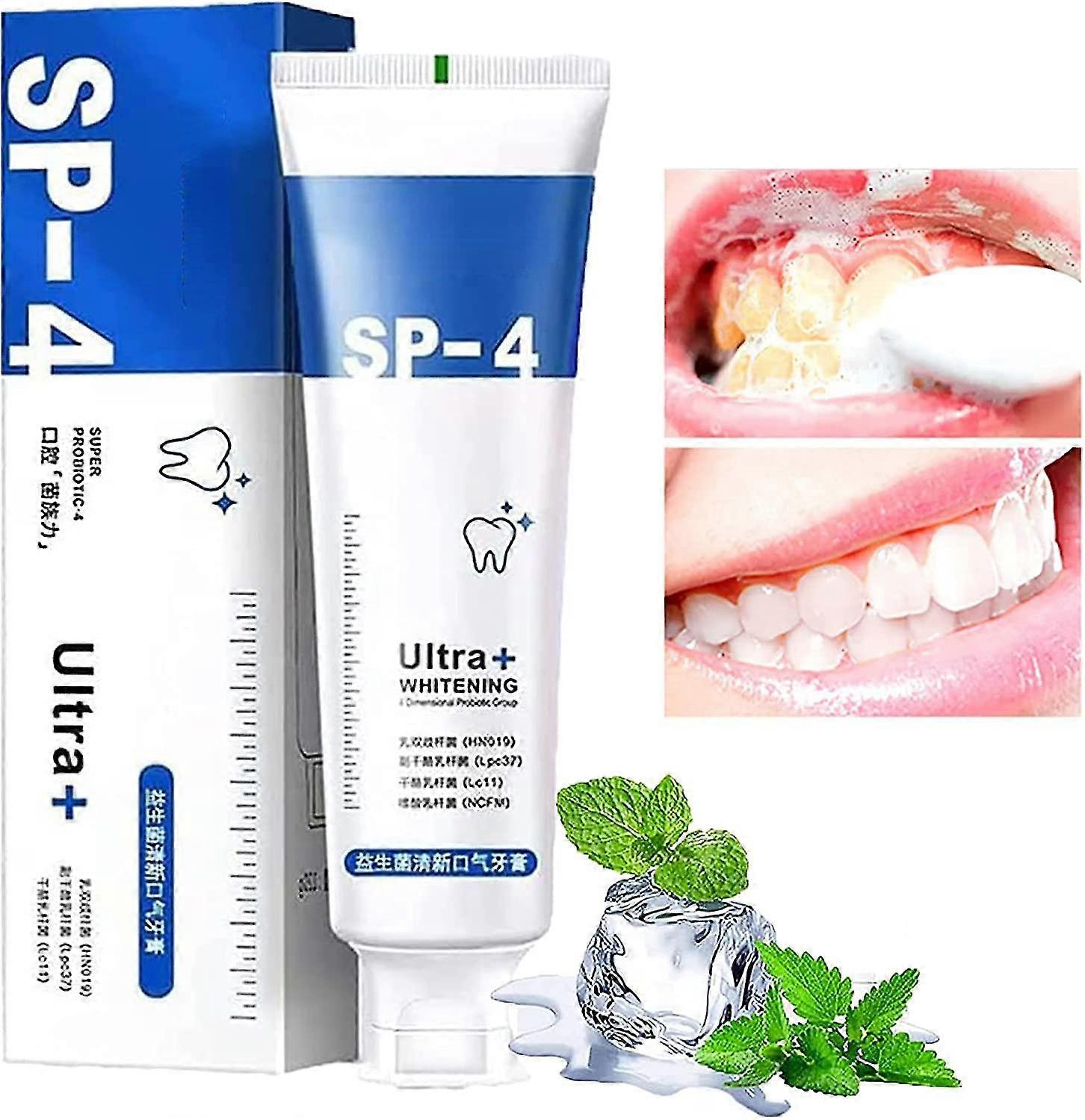 Sp-4 Probiotic Toothpaste, Sp-4 Probiotic Toothpaste Teeth Whitener Toothpaste, Sp-4 Brightening Toothpaste Fresh Breath-1pcs-Blue
