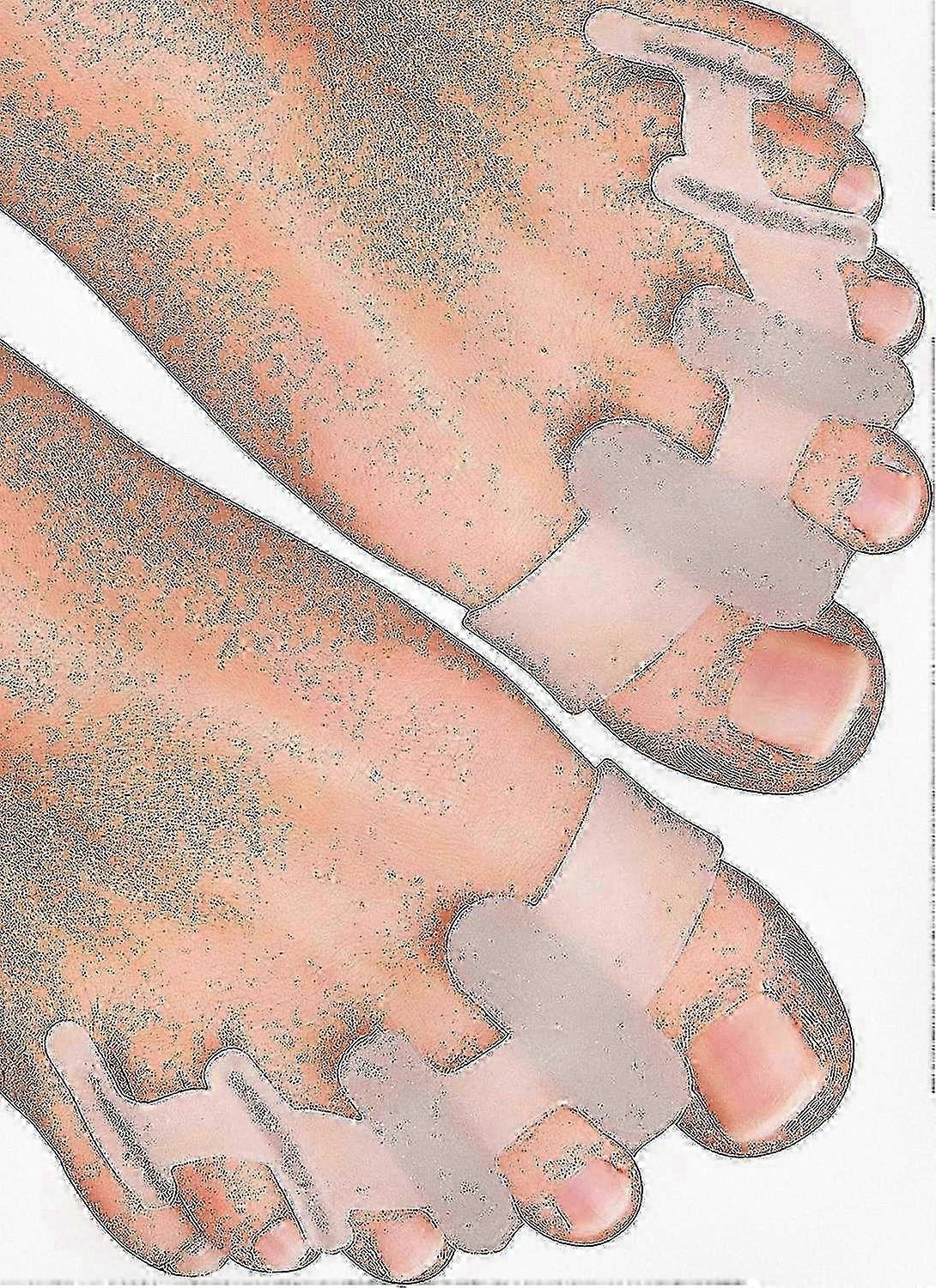 Yogamedic Silicone Toe Separators 6-Pack for Bunion Relief Overlapping Toes Alignment Comfort Stretching BPA-Free 25-26