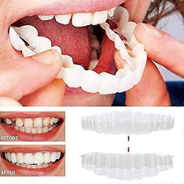 Ssxjx Braces Snap On Upper Fake Teeth Dental Veneers Denture Cover Set