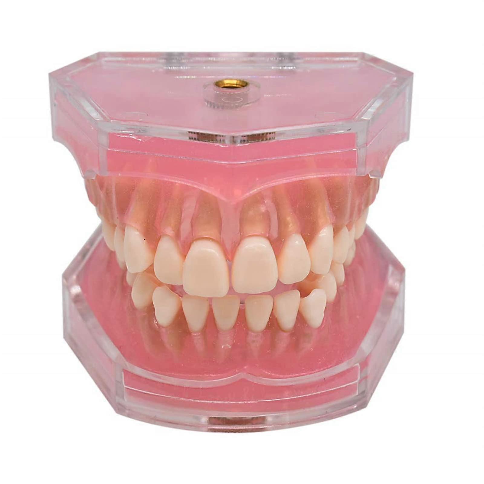 Dental Implant Model with Removable Teeth for Clear Anatomy Visualization and Dental Teaching Use