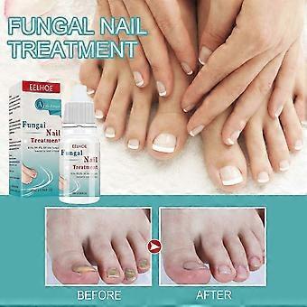Nagelverzorging, nagelreparatievloeistof, extra effectief herstel van schimmelnagels, genezing van verkleurde, beschadigde nagels
