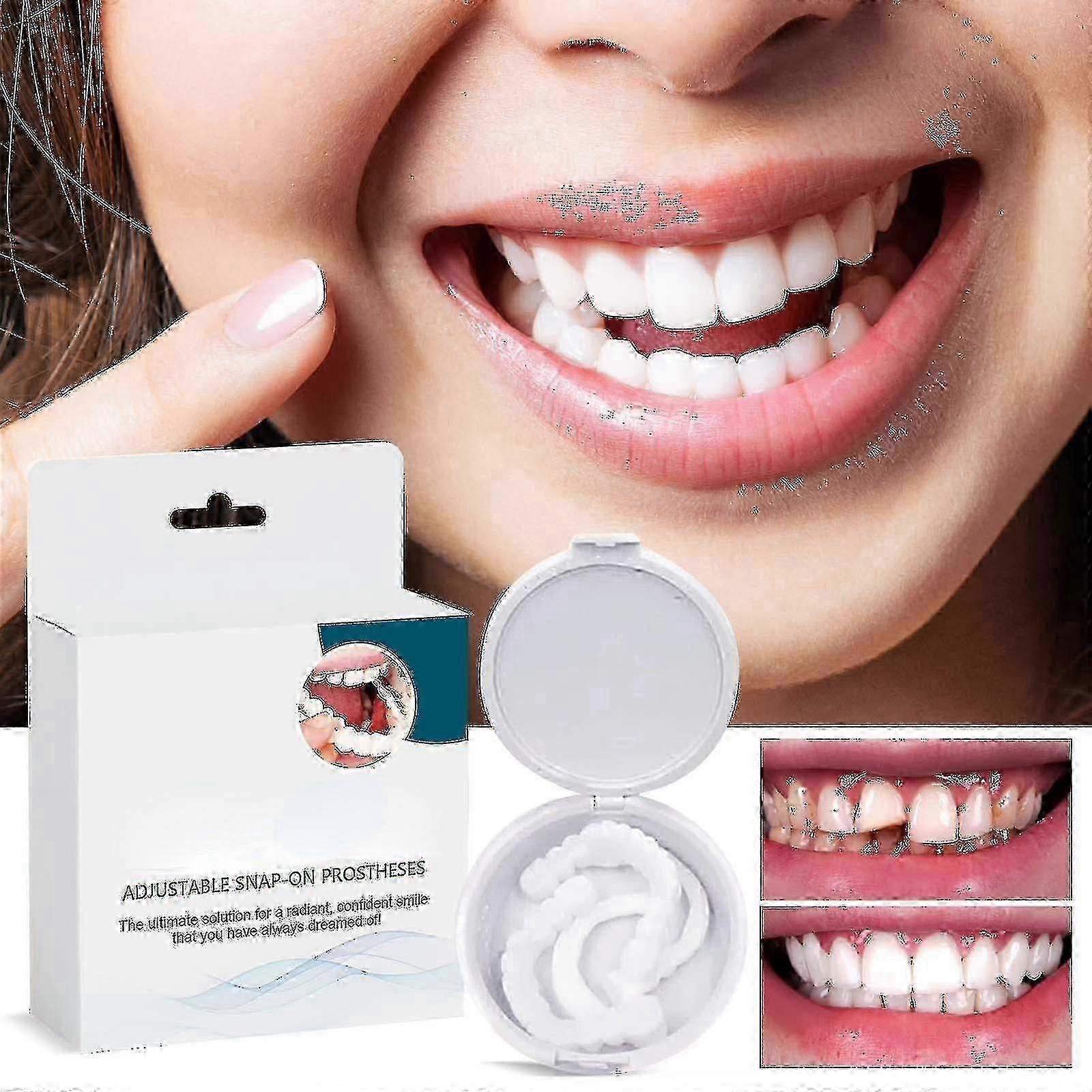 Adjustable Snap On Prothesens, Adjustable Snap On Denture, Silicone Whitening Denture Braces, Cover The Imperfect Teeth